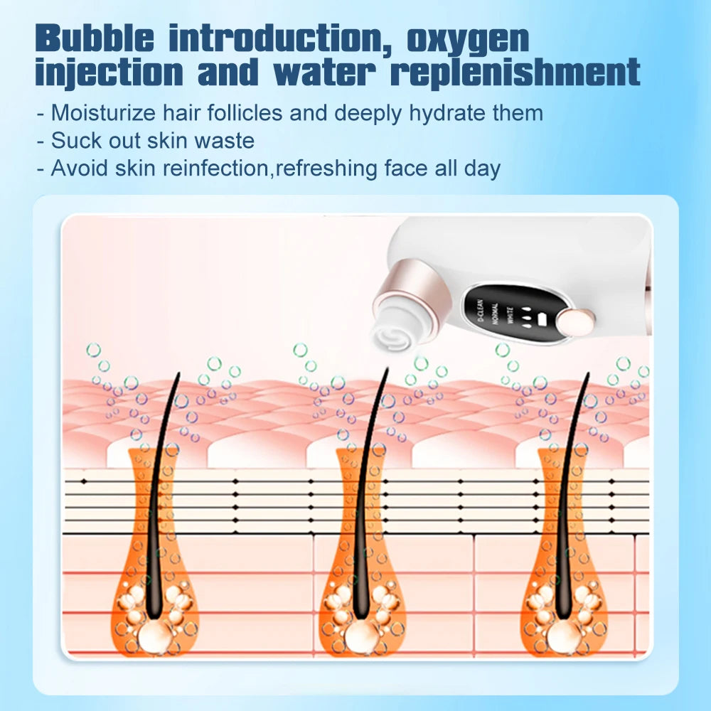 PurePreti Hydro-Facial Blackhead Remover - Oxygen-Infused Bubble Technology, 6 Interchangeable Heads