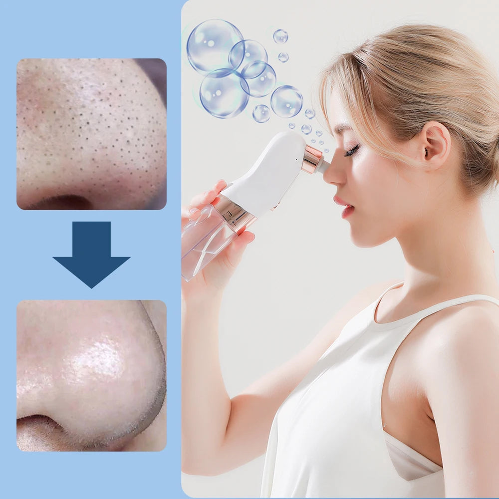 PurePreti Hydro-Facial Blackhead Remover - Oxygen-Infused Bubble Technology, 6 Interchangeable Heads